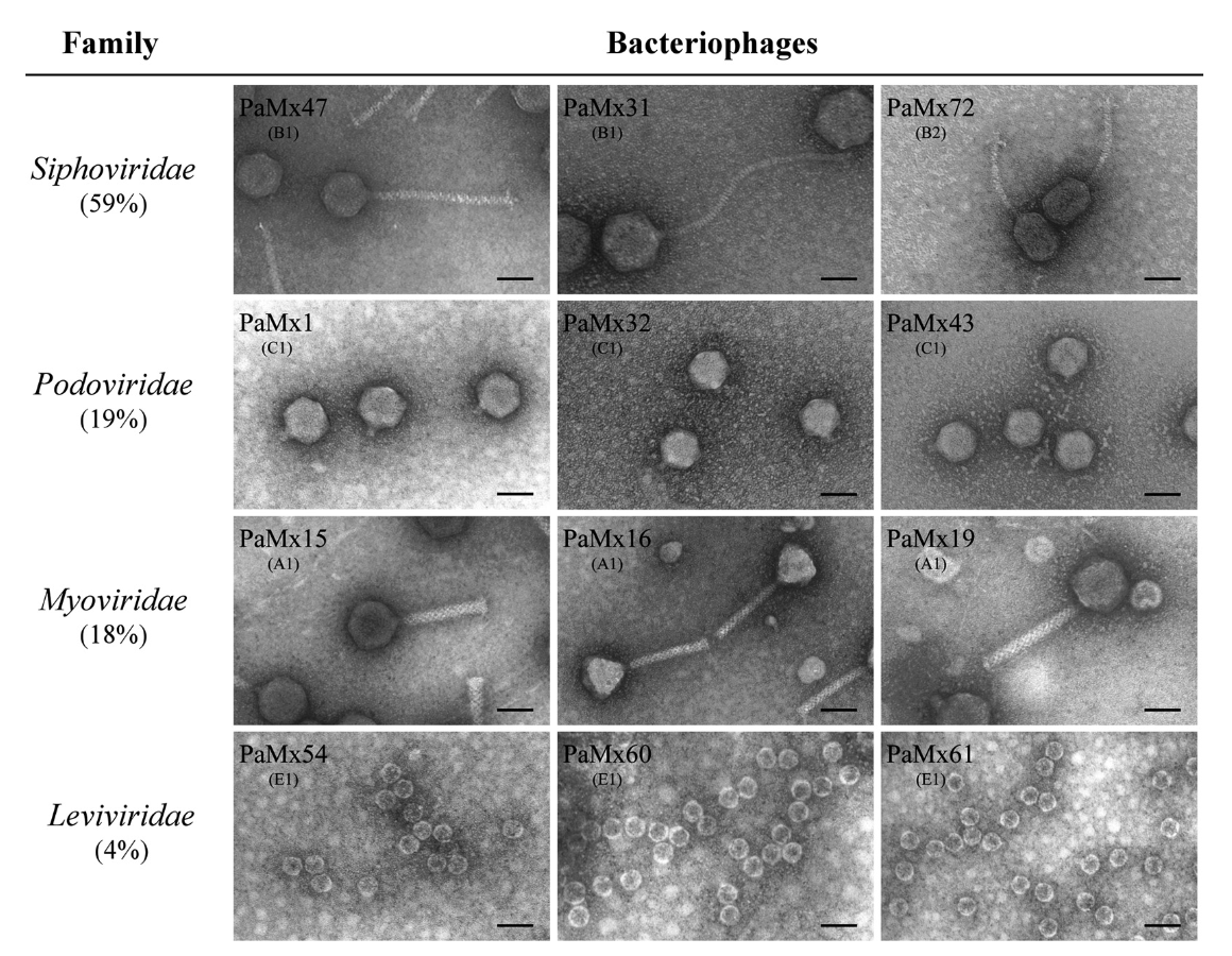 Electron micrographs of bacteriophages